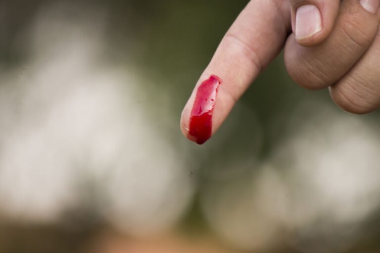 blutender Finger