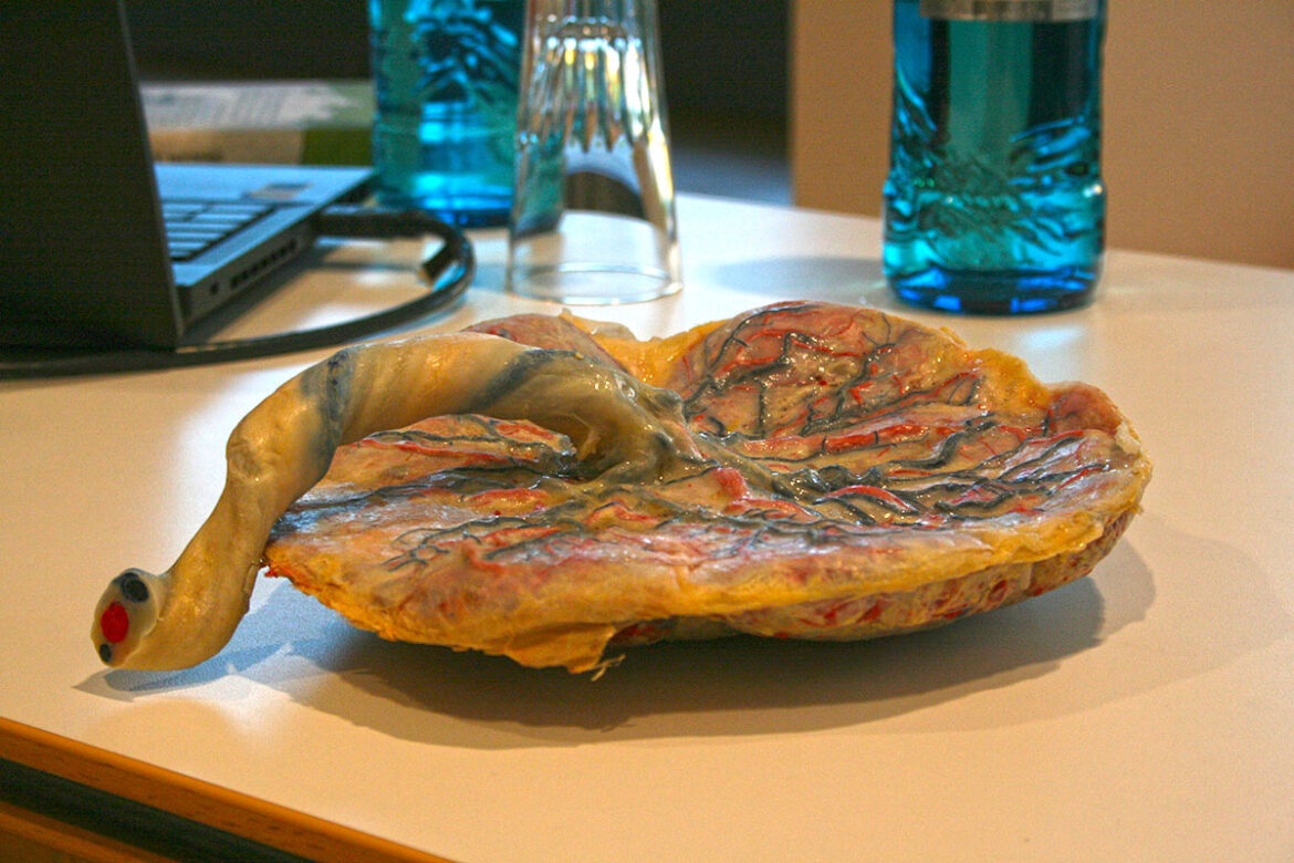 Präparierte Plazenta