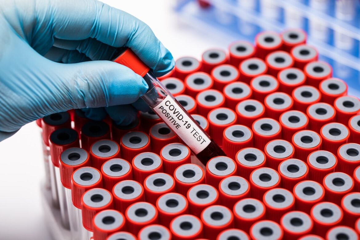 Symbolfoto: Corona-Test