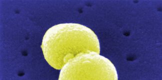 Streptococcus pneumoniae (Archiv), über dts Nachrichtenagentur