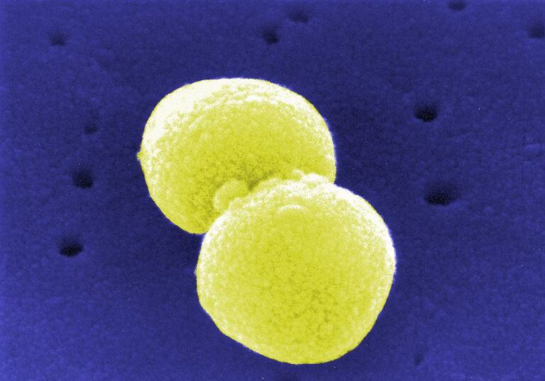 Streptococcus pneumoniae (Archiv), über dts Nachrichtenagentur