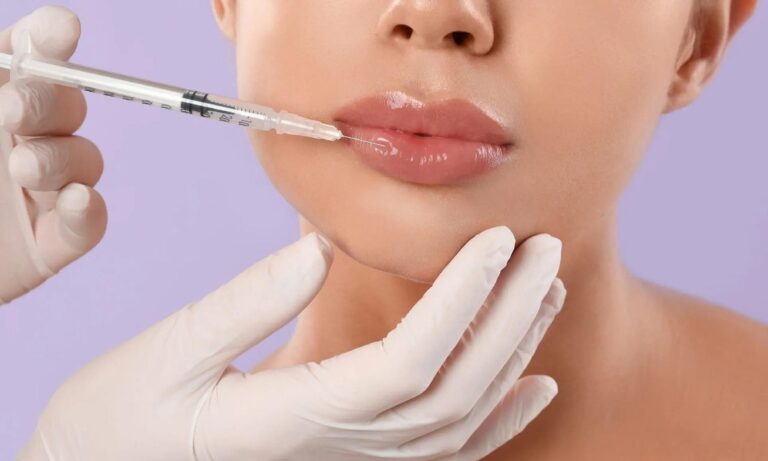 Nahaufnahme einer ästhetischen Behandlung, bei der eine Person in weißen Handschuhen mit einer feinen Spritze Hyaluronsäure in die Lippen einer Frau injiziert.